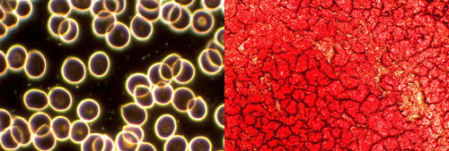 Online Live & Dry Blood Analysis Training